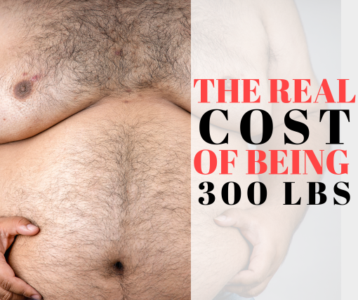 man sitting on scale thinking about the cost of being 300lbs